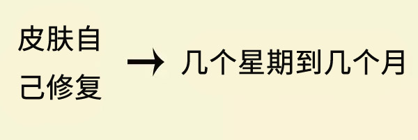  晒后还想白润美 这些晒后修复工作不可少 