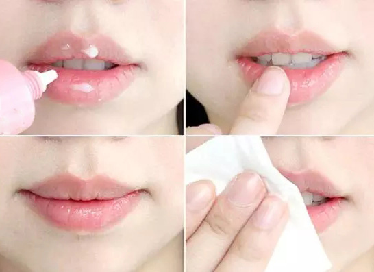  嘟嘴卖萌?麻烦先把唇部保养好再说 